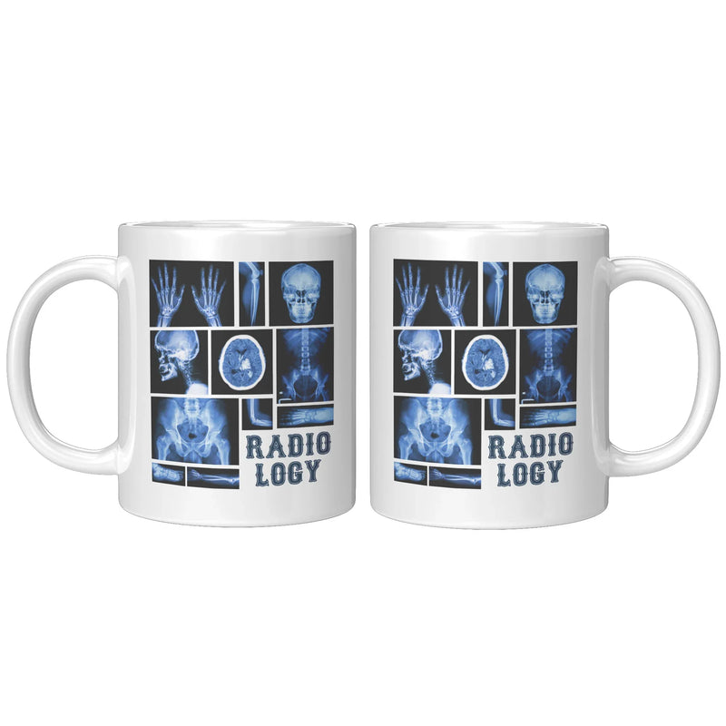 Funny Radiology X-Ray Tech Coffee Mug - Updated - Panvola