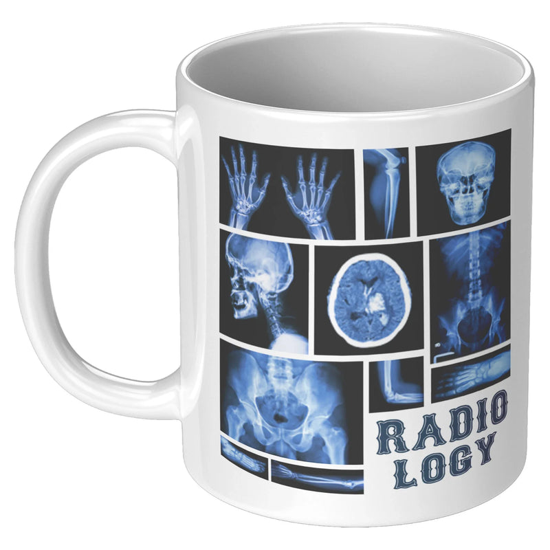 Funny Radiology X-Ray Tech Coffee Mug - Updated - Panvola