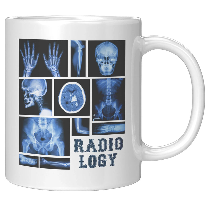 Funny Radiology X-Ray Tech Coffee Mug - Updated - Panvola